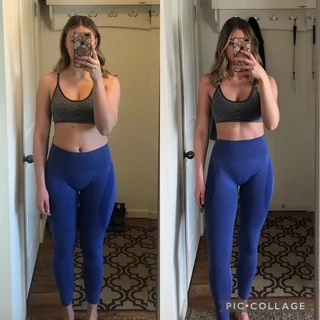 Client side-by-side before and after photo showing a tighter midsection and improved definition